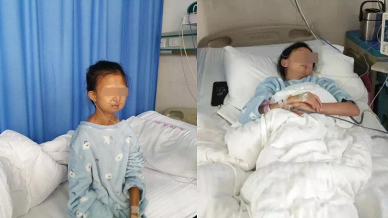 Kisah Haru, Wanita 24 Tahun Ini Miliki Berat 21 Kilogram Demi Sang Adik Akhirnya Meninggal