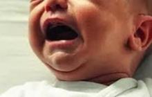 Viral Bayi Umur 13 Bulan Dikerok Babysitter, Ibunda Langsung Syok Lihat Kulit Anaknya