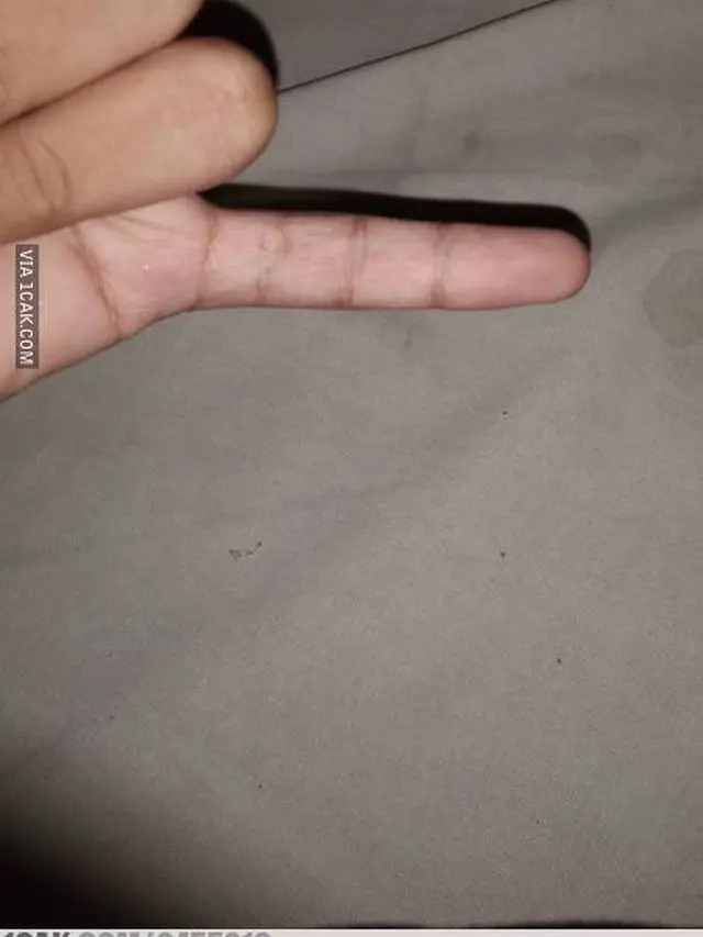 9 Potret Tangan dan Kaki Orang 'Ngebug' Ini Bikin Bingung Lihatnya