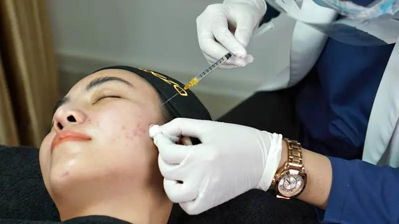 Treatment untuk Mengatasi Melasma atau Flek Hitam Bersama Qeza Aesthetic Clinic