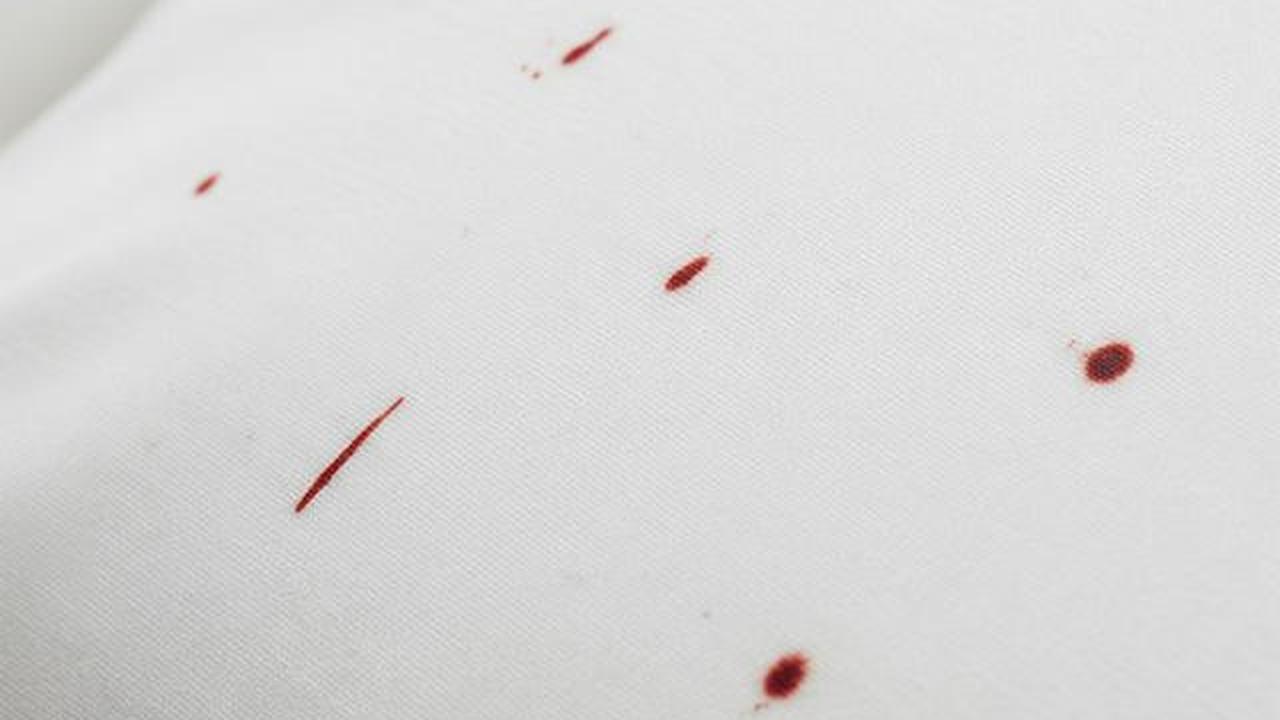Cara Mengetahui Ada Kutu Kasur di Springbed, Lengkap dengan Tanda dan Metode Pengecekannya