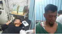 Dua orang jurnalis yang bertugas di Kabupaten Bungo Jambi, mengalami penganiayaan oleh oknum pelangsir BBM di salah satu SPBU di Kabupaten Bungo Jambi (Dok. Pribadi Iwan / Nefri Inge)
