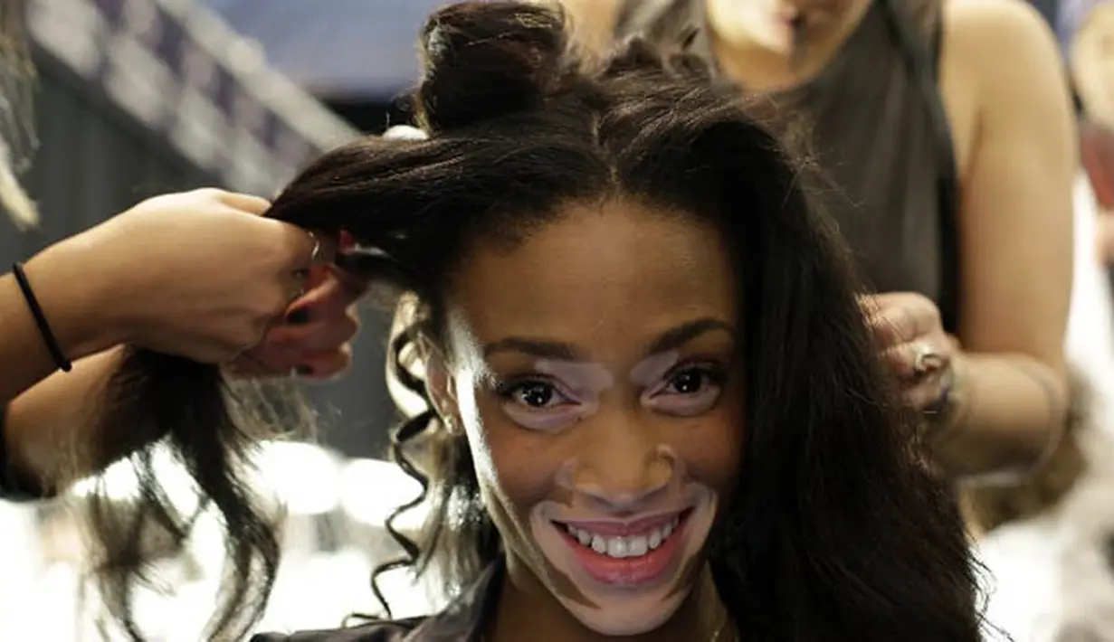 Model Winnie Harlow atau lebih dikenal dengan Chantelle Winnie saat dirias sebelum tampil dalam New York Fashion Week, Amerika Serikat, Kamis (12/2). (AFP PHOTO/JOSHUA LOTT) 