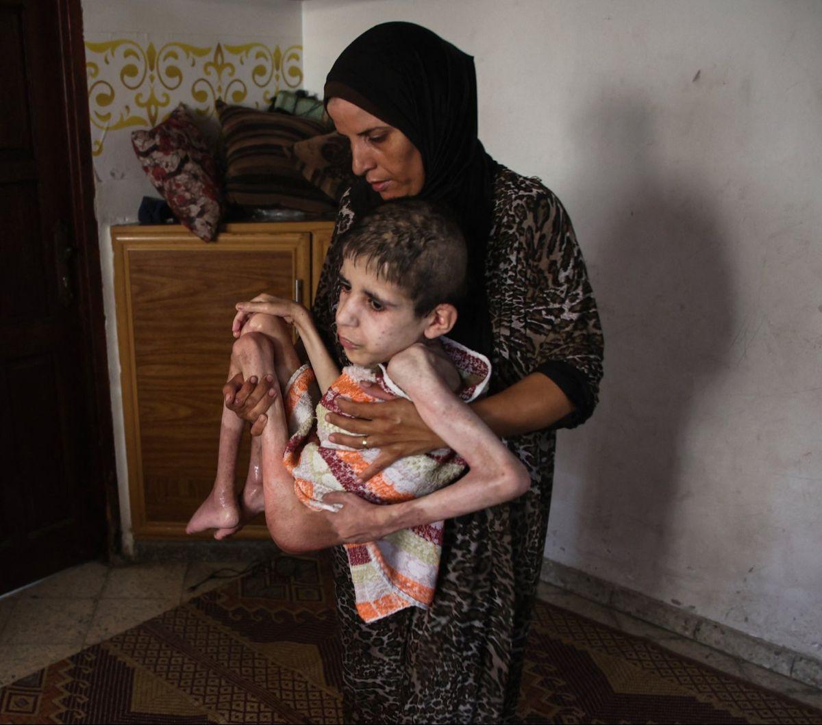 Bahaa al-Nimr, pemuda Palestina yang menderita kelumpuhan otak, digendong ibunya, Sahar, di rumahnya di lingkungan&nbsp;Sheikh Radwan, sebelah utara Kota Gaza, Jalur Gaza, pada 2 Juli 2024.&nbsp;Pengepungan Israel yang menghalangi pengiriman makanan membu