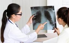 Sering Dianggap Cuma Flu Biasa, Kenali Gejala dan Bahaya Bronkitis