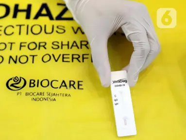 Petugas medis menunjukkan alat Rapid Test COVID-19 di DPP Partai Golkar, Jakarta, Rabu (8/4/2020). Rapid test dilakukan untuk memeriksa virus menggunakan antibodi IgG dan IgM yang ada di dalam darah, antibodi akan terbentuk di tubuh saat mengalami infeksi virus. (Liputan6.com/Helmi Fithriansyah)