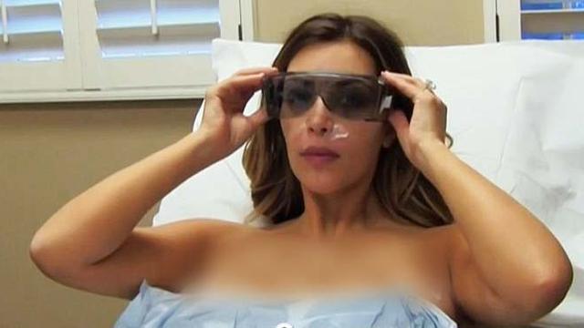 Hilangkan Stretch Mark Di Buah Dada Kim Kardashian Pilih Laser Health Liputan6 Com