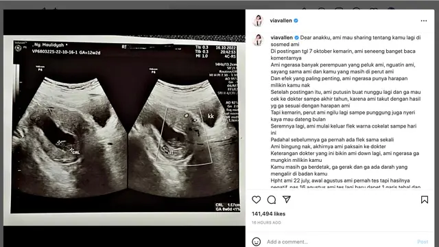 Unggahan Via Vallen. (Foto: Dok. Instagram @viavallen)