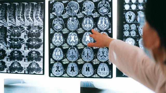 9 Gajala Vertigo yang Sering Terjadi, Ketahui Pertolongan Pertamanya