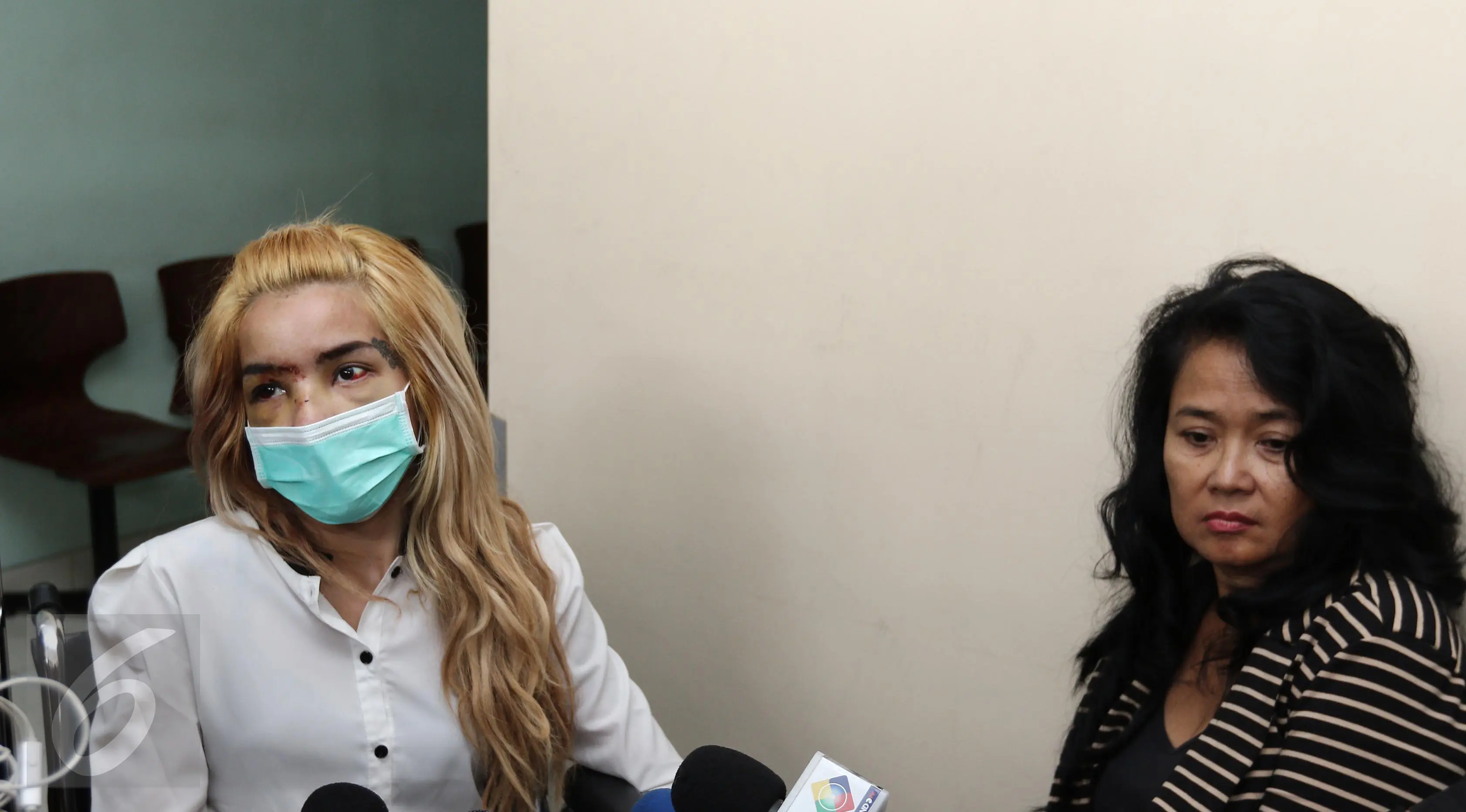 Aktris peran Sheila Marcia ditemani sang ibu menjawab pertanyaan awak media di Rumah Sakit Medistra, Jakarta, Selasa (9/5). Sheila yang beberapa hari terakhir mendapat perawatan akibat kecelakaan mobil sudah diizinkan pulang (Liputan6.com/Herman Zakharia)