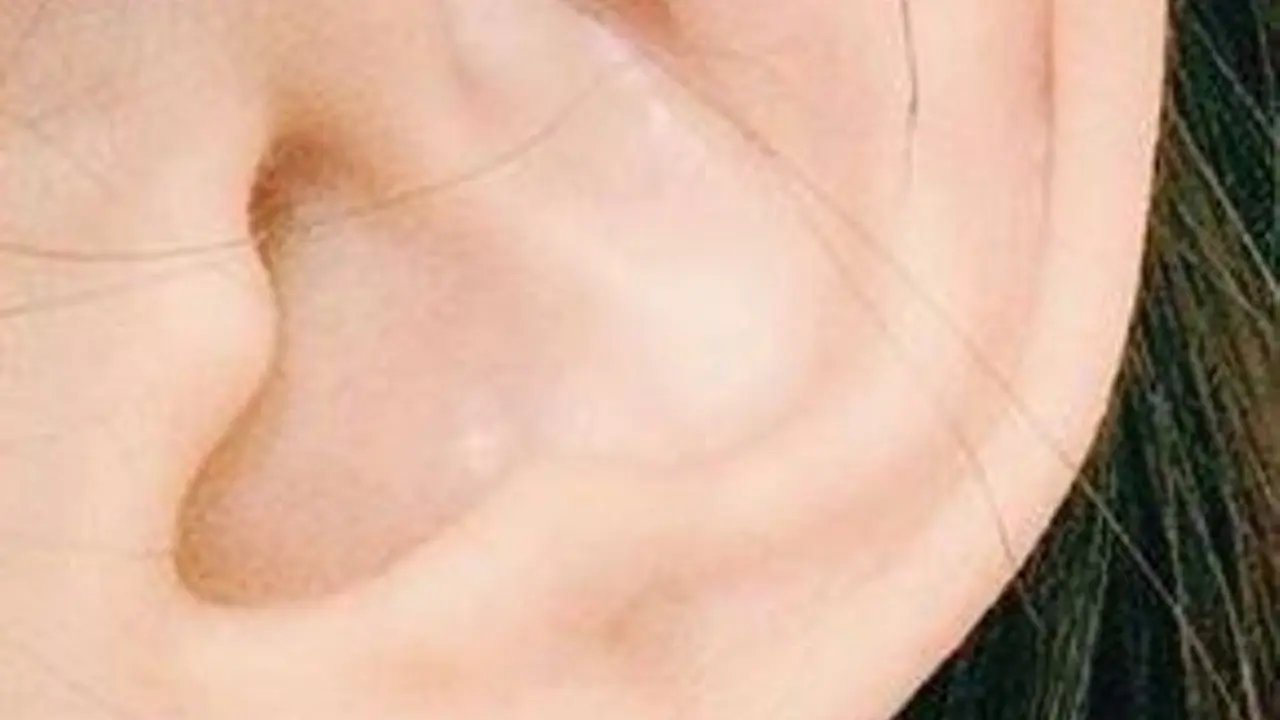 Tato Telinga