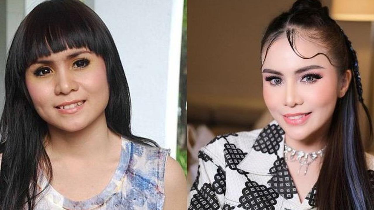 Momo, mantan personel Geisha, juga memiliki gigi gingsul sebelumnya.&nbsp;