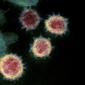 Gambar ilustrasi ini dengan izin dari National Institutes of Health pada 27 Februari 2020. Menunjukkan mikroskopis elektron transmisi SARS-CoV-2 juga dikenal sebagai 2019-nCoV, virus yang menyebabkan Corona COVID-19. (AFP/National Institutes of Health).