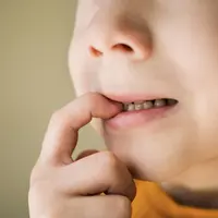 Cara Mengatasi Sariawan pada Anak Tanpa Obat yang Aman dan Efektif