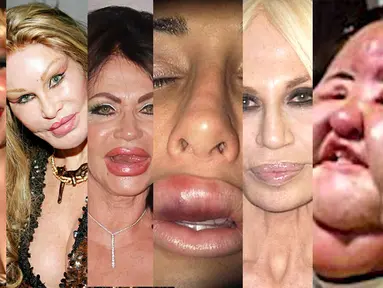 Operasi kecantikan malah membuat enam wanita ini semakin mengerikan (Istimewa)