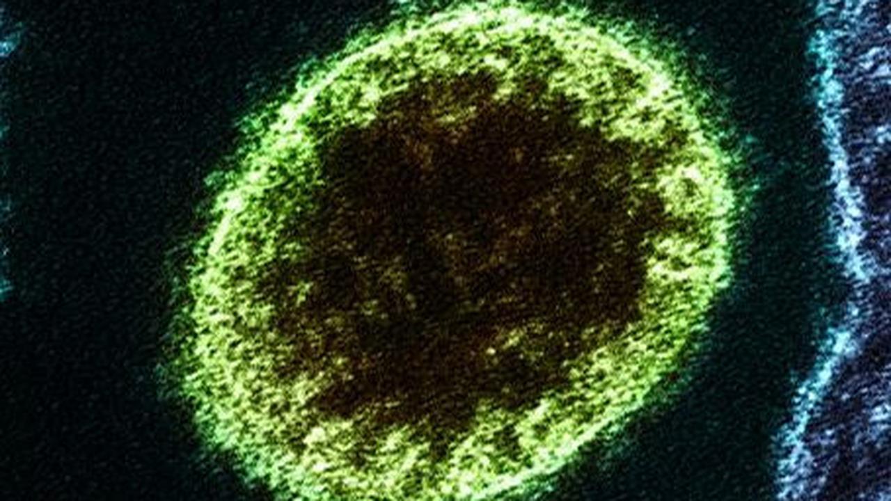 Gejala Virus Nipah yang Perlu Diwaspadai, Begini Cara Mencegahnya