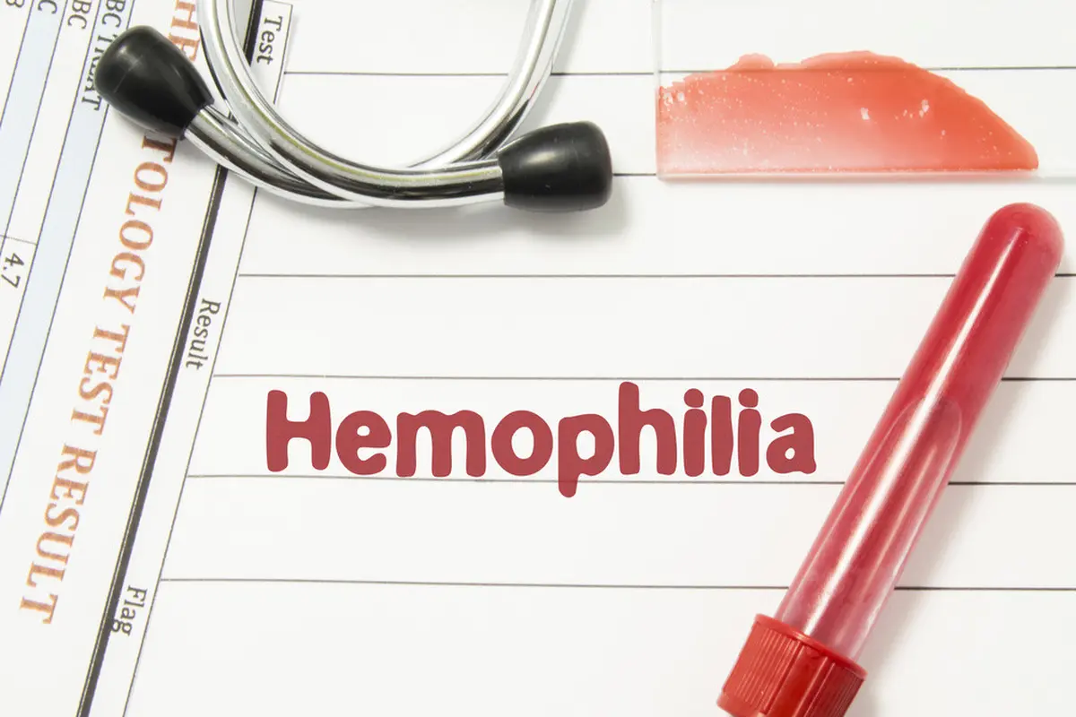 Benarkah Hemofilia Lebih Mudah Menyerang Pria? (Shidlovski/Shutterstock)