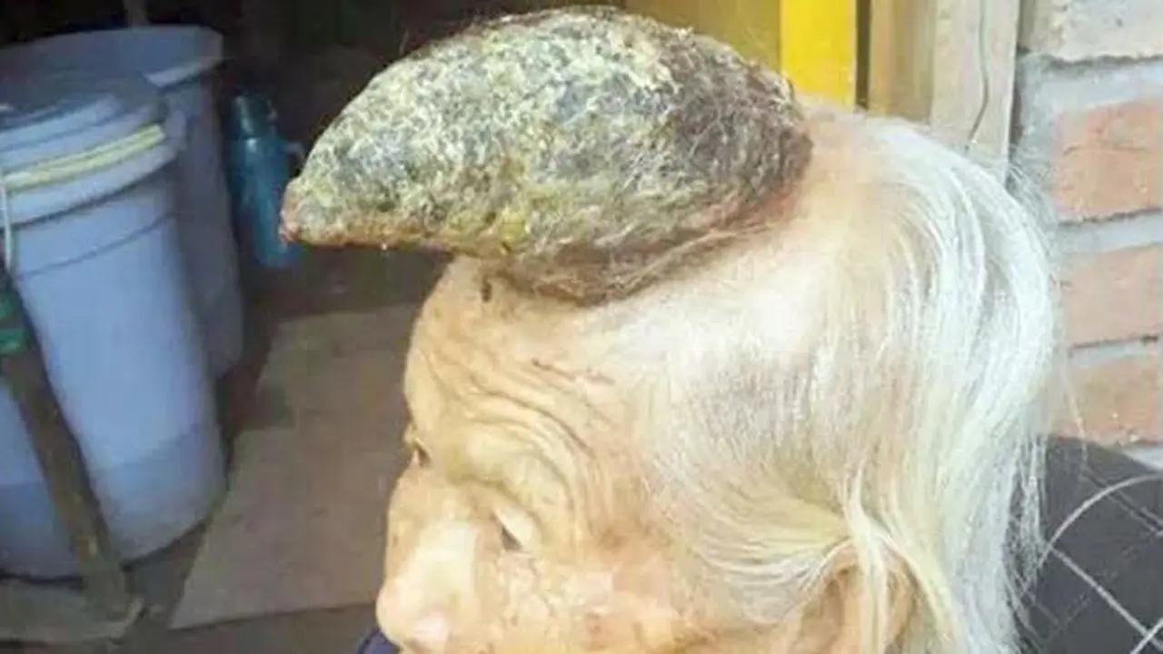 Nenek 87 Tahun Bertanduk Kerbau Hebohkan Publik