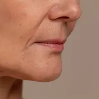 Kenali jenis kerutan dan garis halus dan penyebabnya berikut ini! [Dok/Neutrogena].