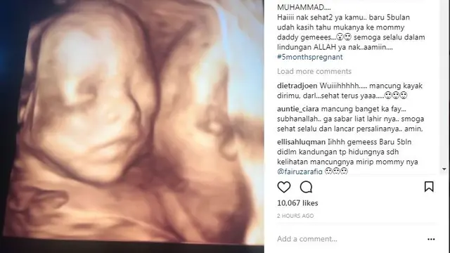 Calon Bayi Fairuz A Rafiq