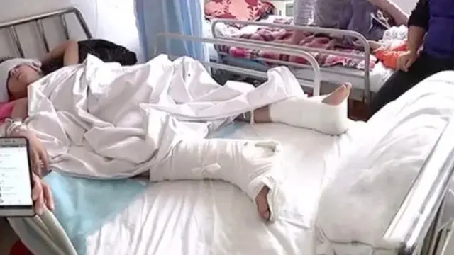 Tiru Adegan Gim Favorit, Bocah Ini Lompat dari Gedung Bersama Adiknya