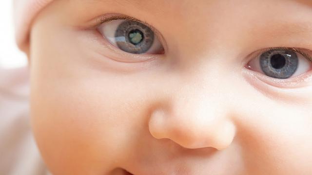 [Bintang] Ilustrasi Bayi Katarak