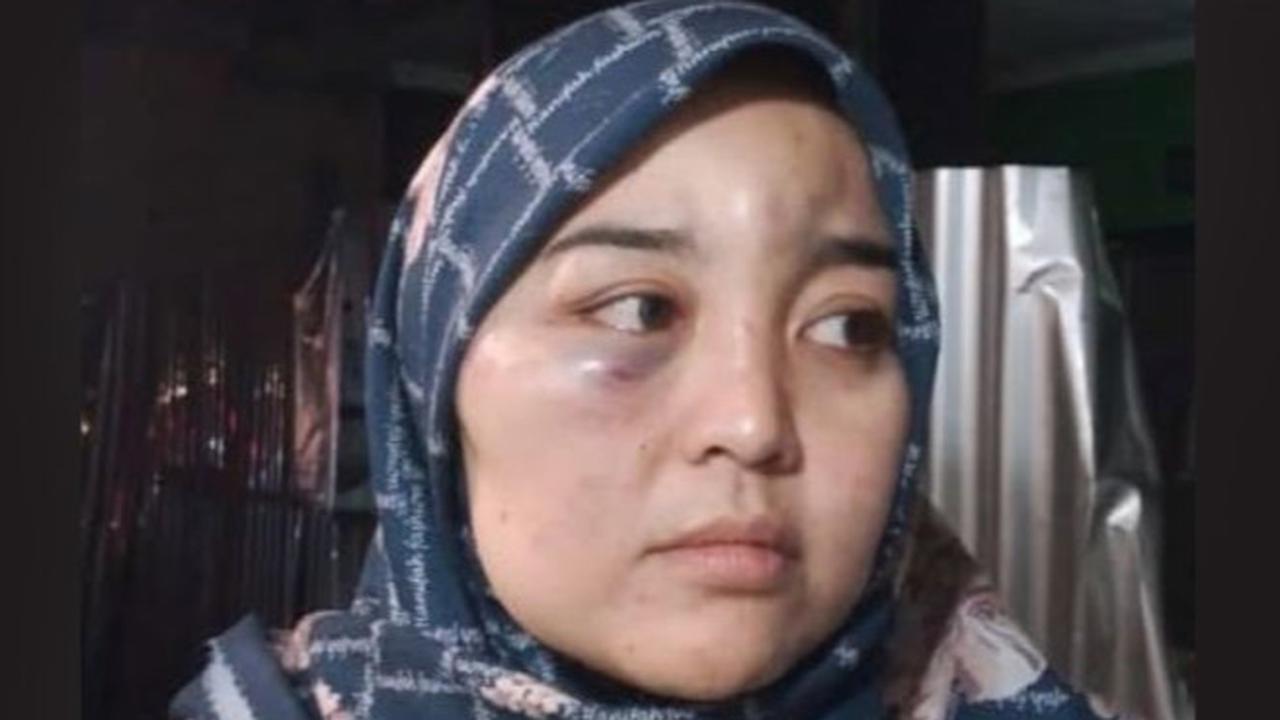 Viral Istri di Garut Diduga Dianiaya Suami hingga Luka Parah karena Dituduh Selingkuh