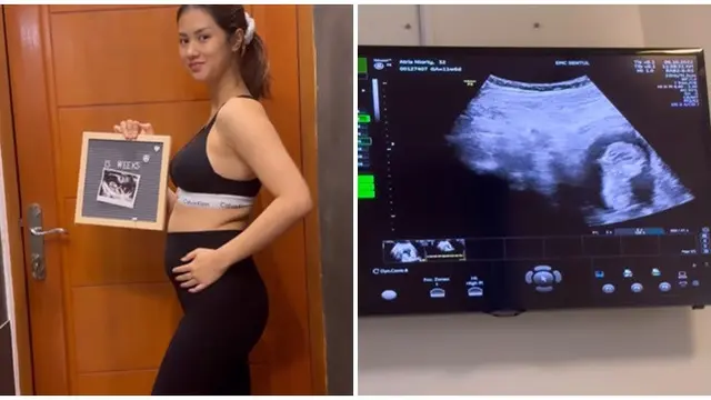 Hamil Setelah 2 Kali Gagal Bayi Tabung, Ini 6 Momen Perjuangan Atries Angel