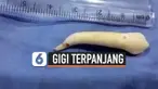 vertical gigi