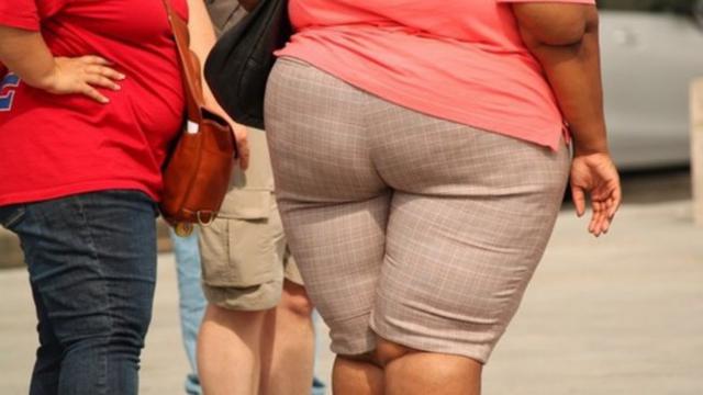 Obesitas atau kegemukan bukan lagi menjadi hal yang aneh di masyarakat kini. Tetapi bukan berarti hal ini bisa dimaklumi atau dibiarkan.