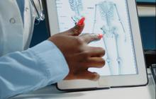 Cara Mencegah Osteoporosis Sejak Usia Muda, Jangan Tunda Nanti