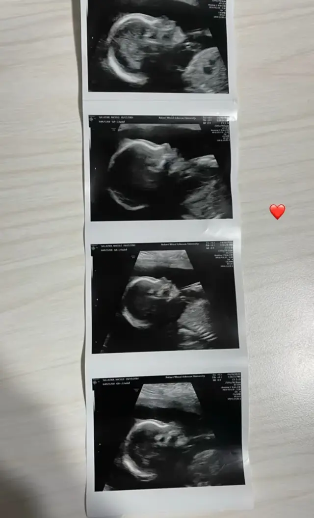 Perut wanita ini rata dari awal hamil hingga melahirkan, 9 potret perjalanan kehamilannya bikin heran