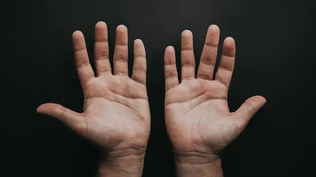 Tangan Sering Kesemutan? Bisa Jadi Ada Gangguan Saraf