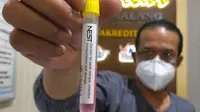 Petugas Laboratorium Kesehatan Daerah (Labkesda) Kota Malang memperlihatkan tempat pengambilan salah satu sampel bagian dari tes swab massal demi mencegah penyebaran Covid-19 di Malang (Liputan6.com/Zainul Arifin)