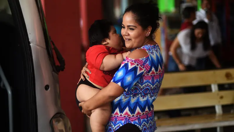 Berat 28 Kg, Bayi 10 Bulan di Meksiko Alami Obesitas