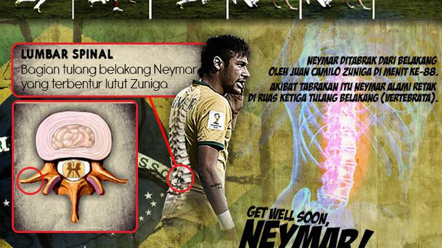 Infografis Cedera Tulang Belakang Neymar