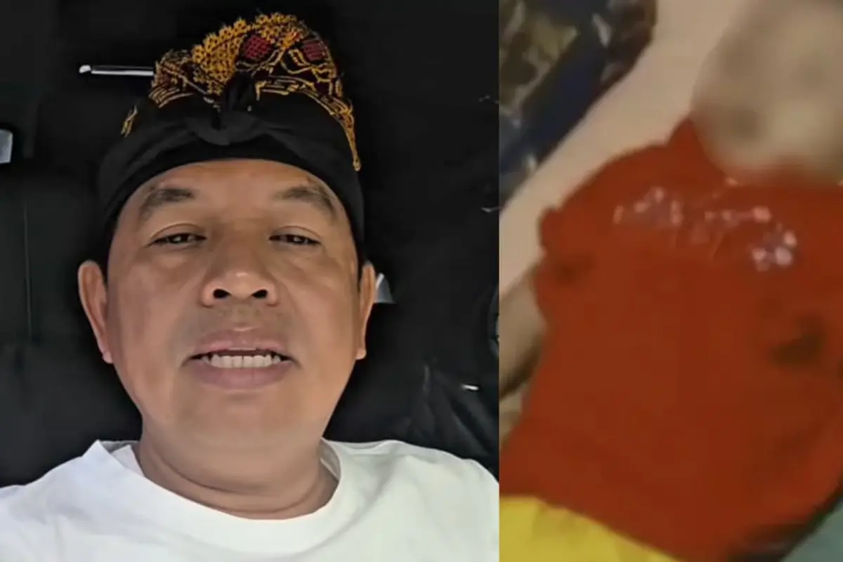 Bocah Sukabumi Meninggal dengan Tubuh Penuh Cacing, Dedi Mulyadi Himpun Informasi dari Dokter yang Menangani