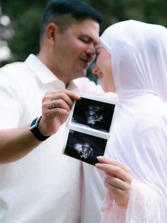 Irish Bella Umumkan Kehamilan Pertama dengan Haldy Sabri, Tampil Modest Bernuansa Pastel