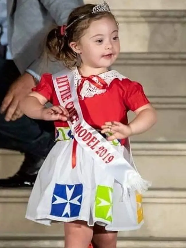 francesca model down syndrome berusia 4 tahun