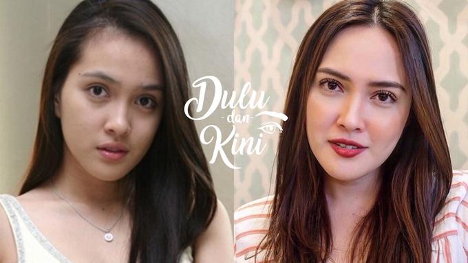 Dulu Dan Kini Transformasi Shandy Aulia Yang Cantiknya Awet Beauty Fimela Com