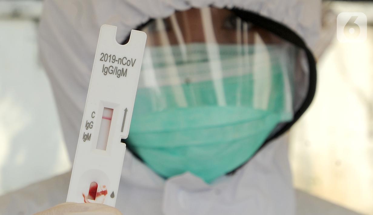 Paramedis Siloam Hospitals menunjukkan hasil tes cepat (rapid test) mandiri COVID-19 secara drive thru di Akses Senayan Park Jalan Gerbang Pemuda, Jakarta, Kamis (23/4/2020). Rapid Tes Covid -19 dibanderol seharga Rp 489.000, periode 17-30 April 2020 pukul 08.00-10.00 WIB. (merdeka.com/Arie Basuki)