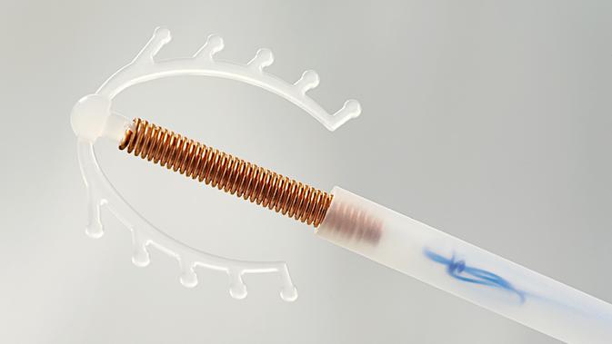 Ilustrasi alat KB IUD atau spiral (iStockphoto)