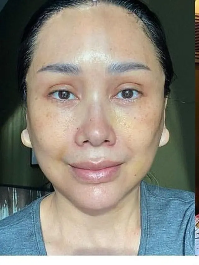 6 Potret Transformasi Titi DJ Usai Operasi Anti Aging, Makin Awet Muda