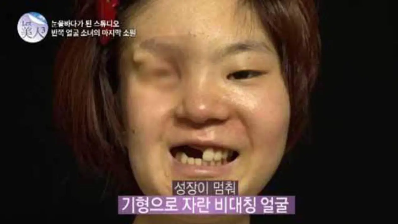 Gadis Berwajah Separuh
