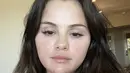Selena Gomez menjadi selebritas yang berani tampil dengan wajah bare face. Ia tanpa ragu memperlihatkan kondisi kulitnya yang menjadikan dirinya semakin inspiratif. [Foto: Selena Gomez/ Instagram]