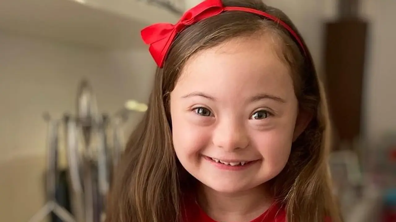 francesca model down syndrome berusia 4 tahun