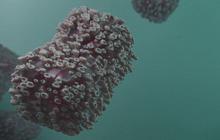Perbedaan Gejala Mpox dan Cacar Air, Ada Pembengkakan Kelenjar Getah Bening