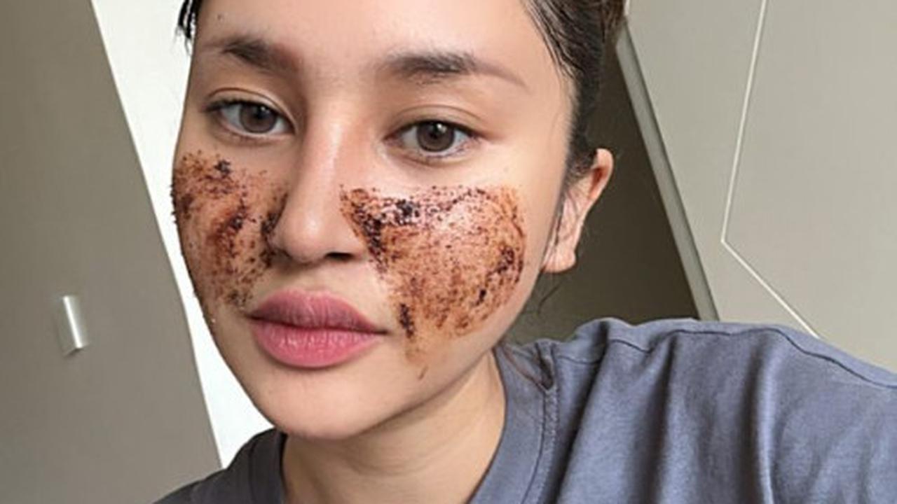 Hasil Oplas Hidung Dhyaz