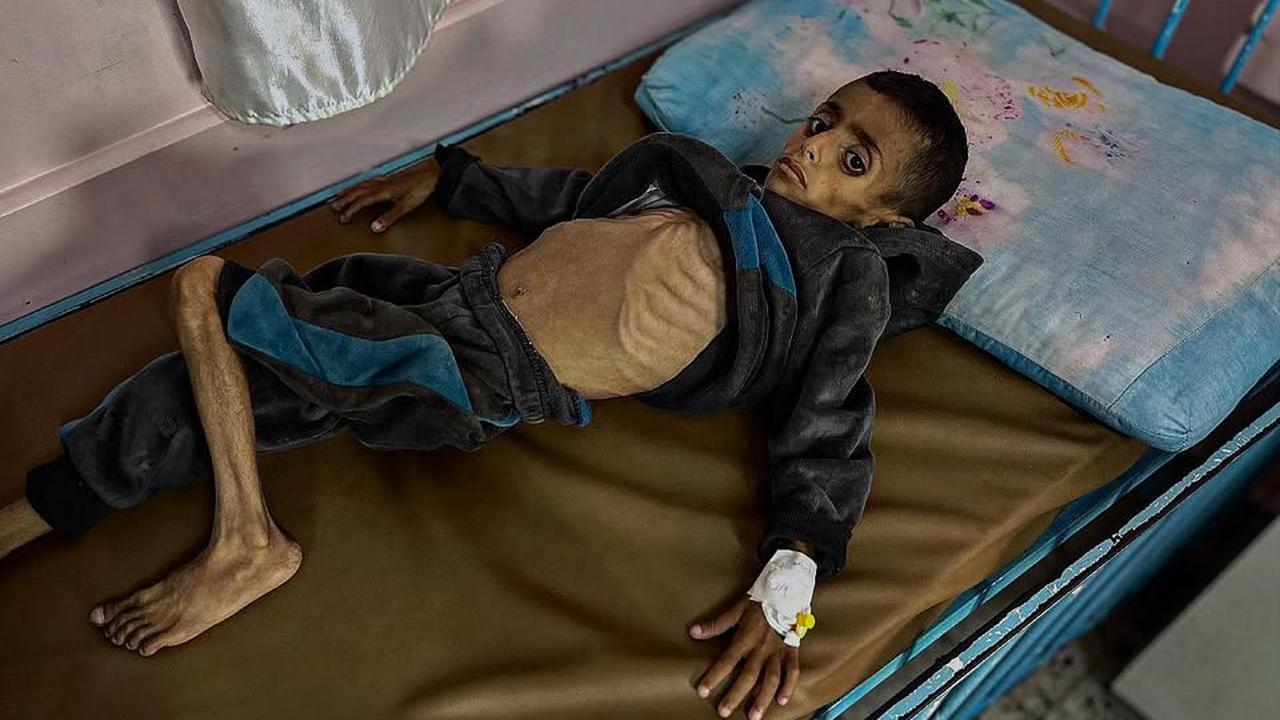Sejauh Mata Memandang, Anda Melihat Orang-Orang Kurus Kering Kelaparan