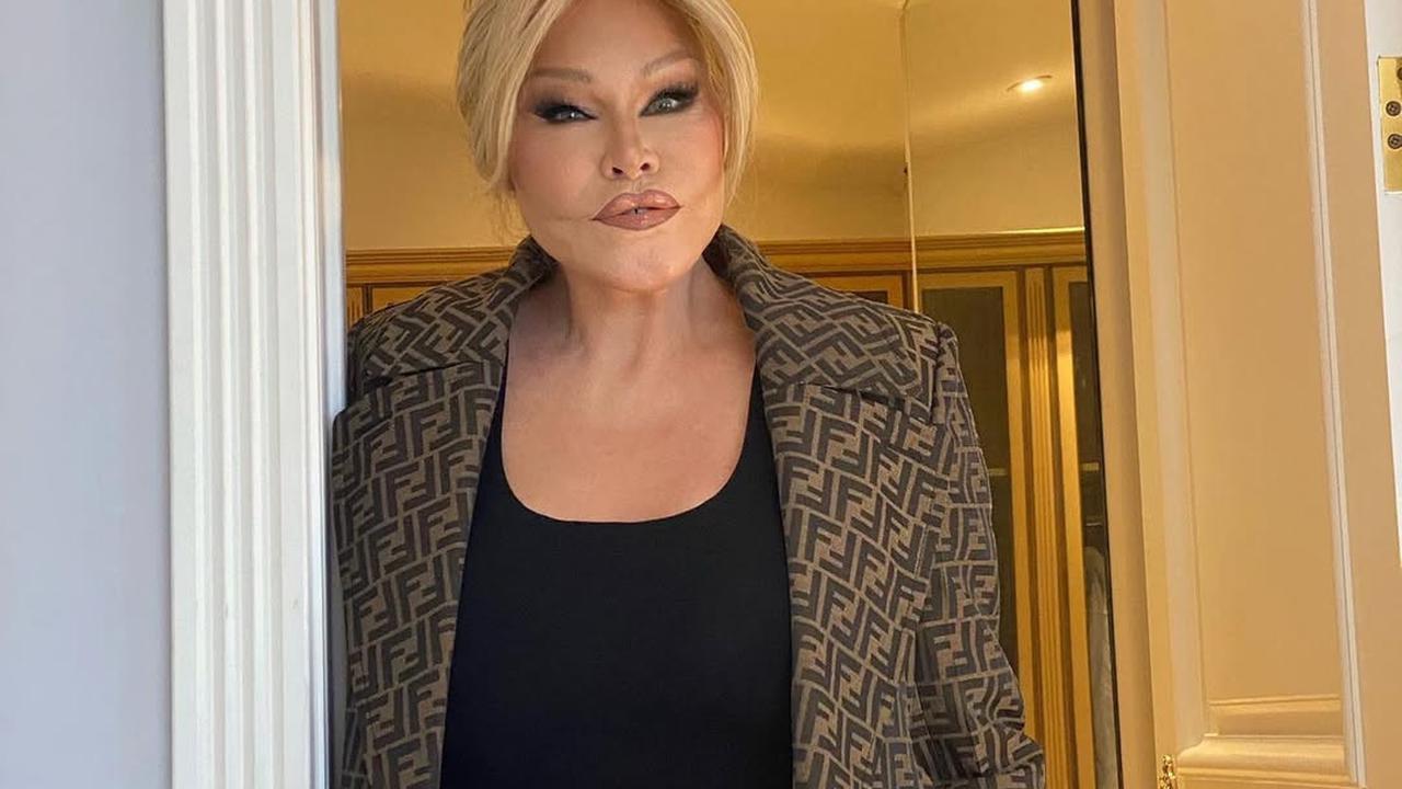 Jocelyn Wildenstein, Perempuan Berjuluk Catwoman Meninggal Dunia